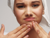 what causes adult acne in women